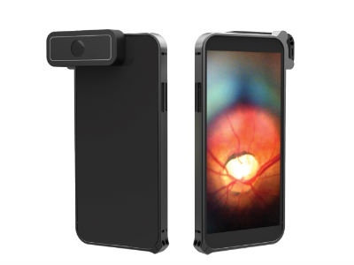  D-EYE to Showcase Smartphone-Based Digital Ophthalmoscope at ARVO