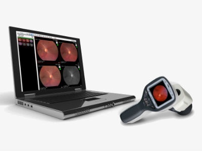 Optometry Workstation Volk Releases Pictor Workstation Software Platform | OptometryWeb: The ...