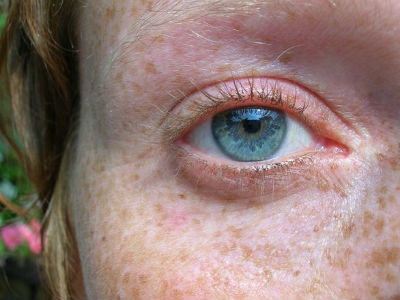  New Report Issues Call to Action to Eliminate Correctable, Avoidable Vision Impairment by 2030