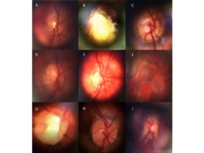  D-EYE Introduces ImageSelect, Shares Comparison Study