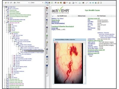 Optometry Electronic Medical Record (EMR) Software | OptometryWeb: The ...